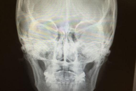 最新の技術